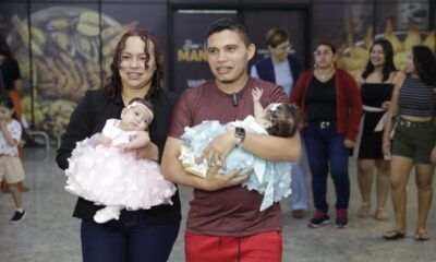 gêmeas-siamesas-separadas-canal92am