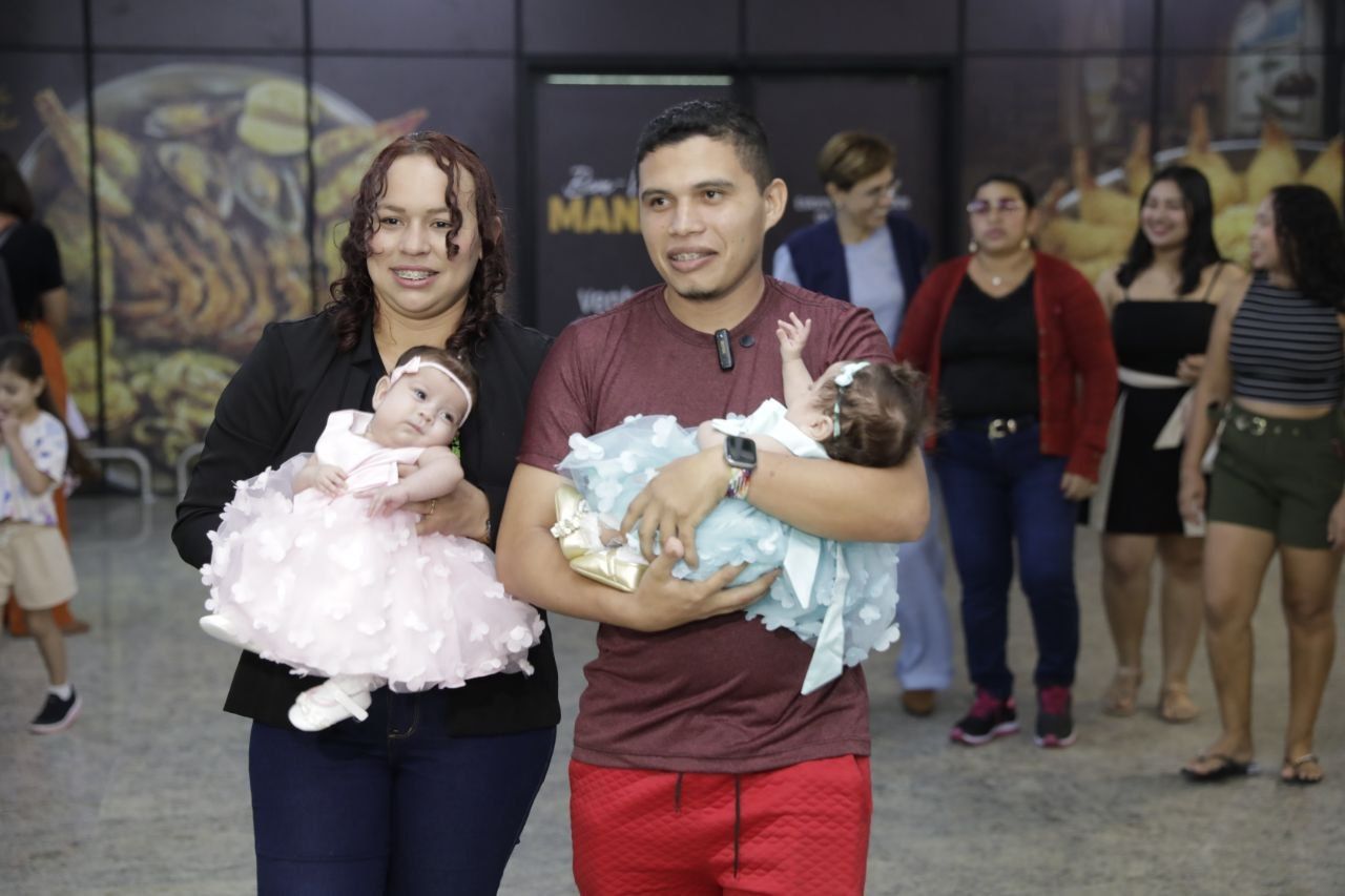 gêmeas-siamesas-separadas-canal92am