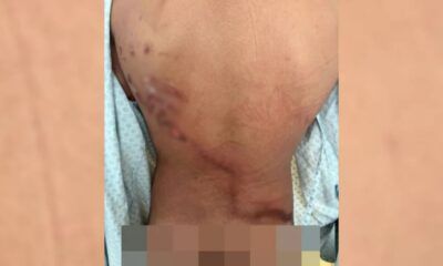 achei-que-so-ficaria-vivo-por-