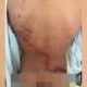achei-que-so-ficaria-vivo-por-
