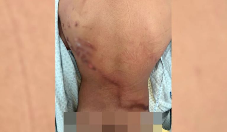 achei-que-so-ficaria-vivo-por-
