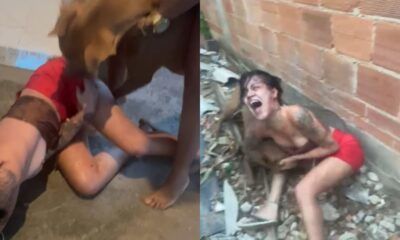 jovem-mordida-pitbull-canal92am