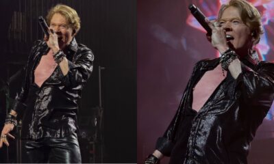 axl-rose-cirurgia-mandibula-canal92am