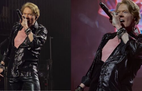 axl-rose-cirurgia-mandibula-canal92am